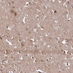 RCOR2 Antibody, Novus Biologicals 0.1mL; Unlabeled:Antibodies, Polyclonal